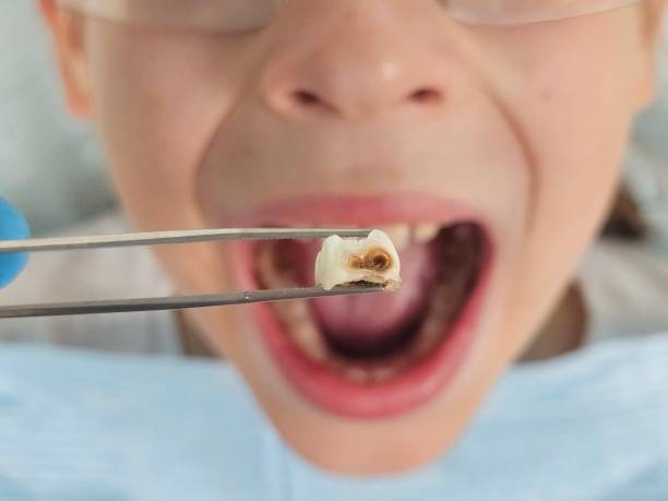 Best Pediatric Emergency Dentist in Ellisburg, NJ